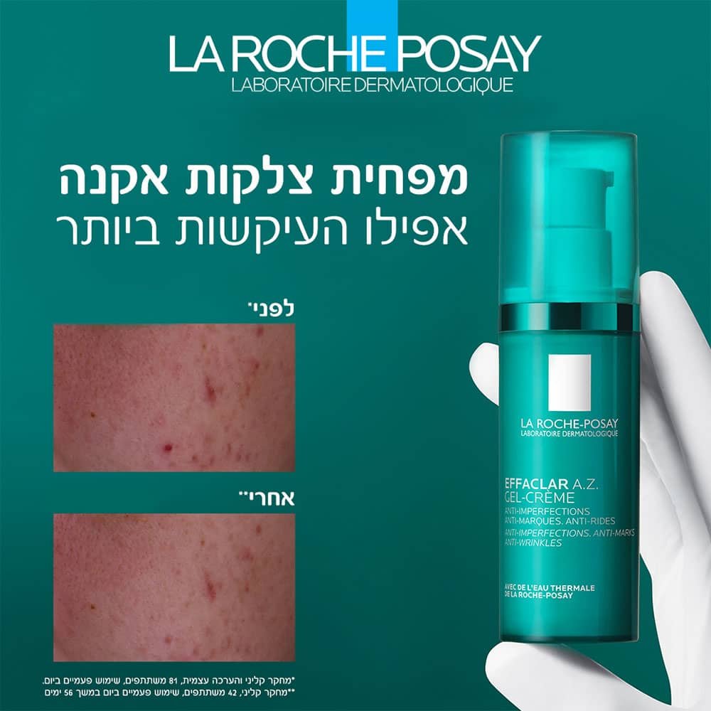 מפחית צלקות אקנה אפילו העיקשות ביותר. תצוגת עור לפני ואחרי השימוש בקרם.